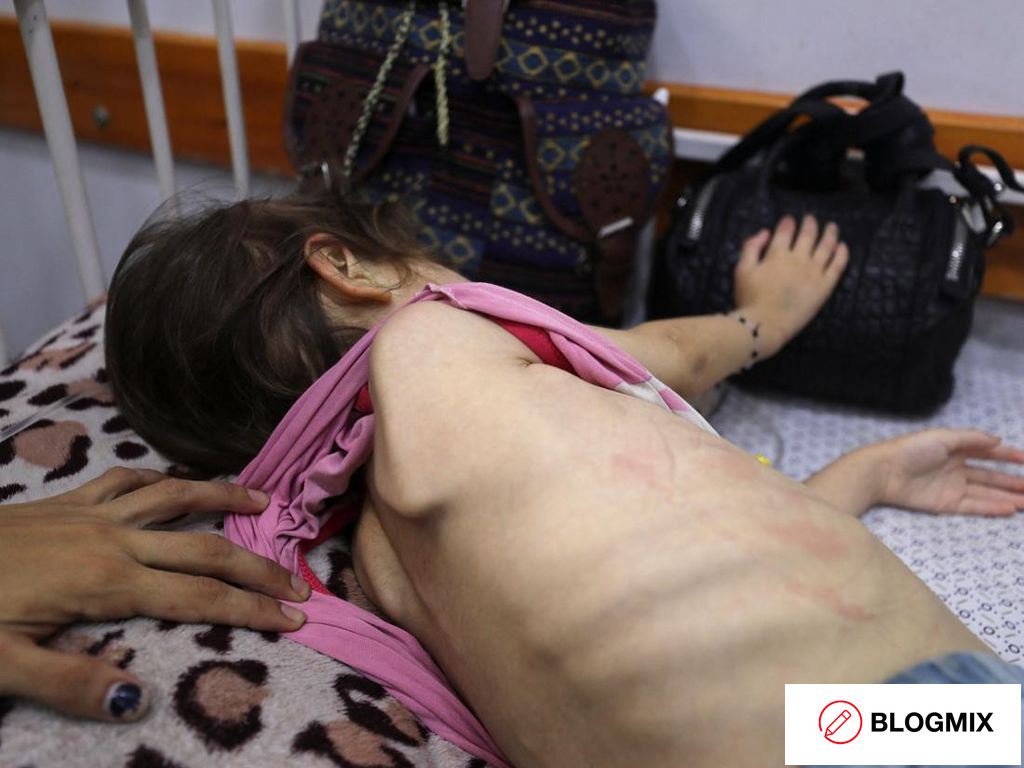 Dialami Banyak Anak di Gaza, Ini yang Terjadi pada Tubuh Saat Kelaparan